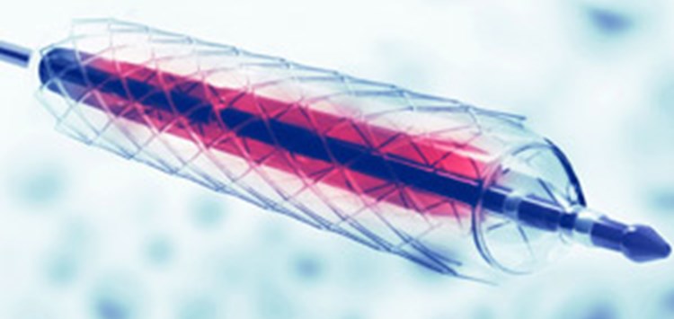 Klebstoff für Katheter der nächsten Generation